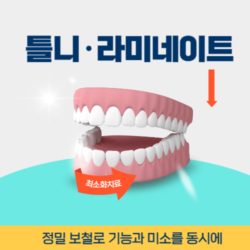 여주치과 여주시 치과 틀니 라미네이트