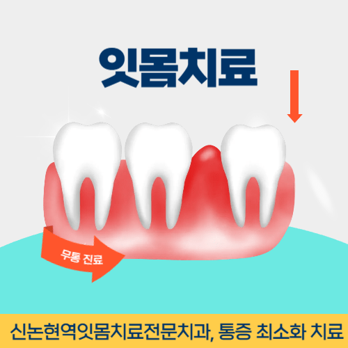 여주치과 여주시 치과 잇몸치료